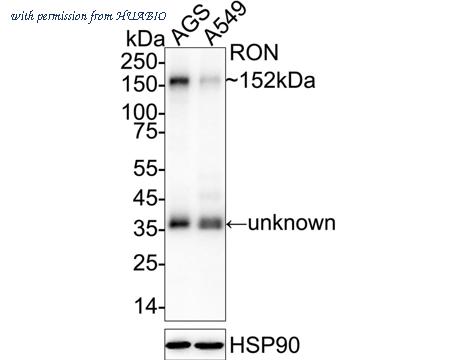 HUABIO ET1612-80 image 1