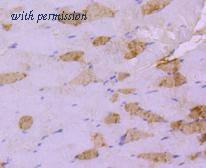 HUABIO ET1612-81 image 3