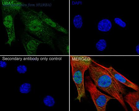 HUABIO ET1612-82 image 3