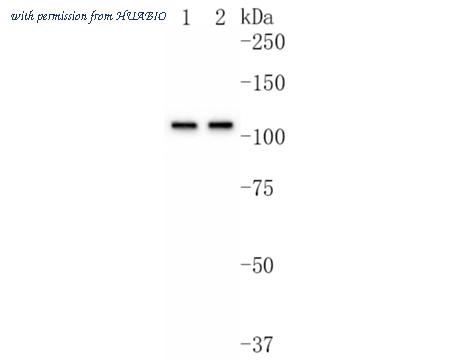 HUABIO ET1612-83 image 2