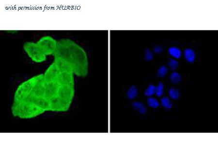 HUABIO ET1612-83 image 3