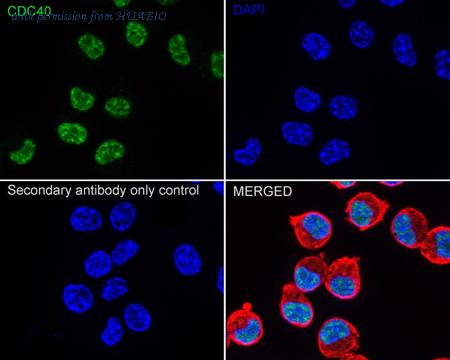 HUABIO ET1612-85 image 2