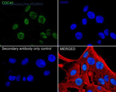 HUABIO ET1612-85 image 3