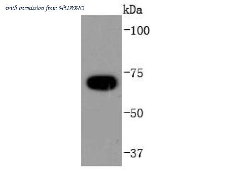 HUABIO ET1612-86 image 2