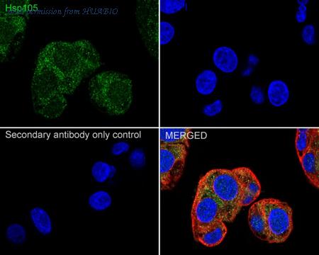 HUABIO ET1612-88 image 3