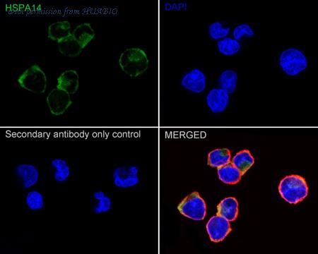 HUABIO ET1612-93 image 2
