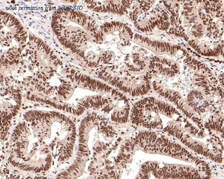 HUABIO ET1612-94 image 3