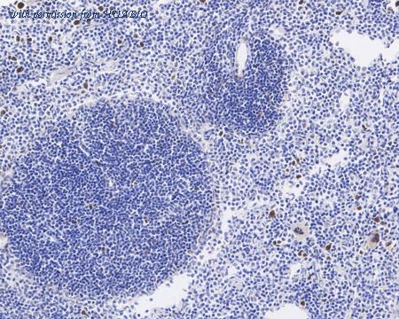 HUABIO ET1612-96 image 3