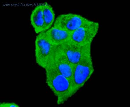 HUABIO ET1612-97 image 3