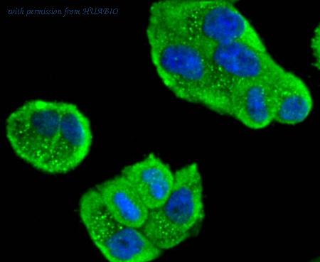 HUABIO ET1612-98 image 3