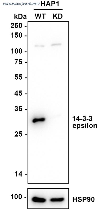 HUABIO ET1701-1 image 1