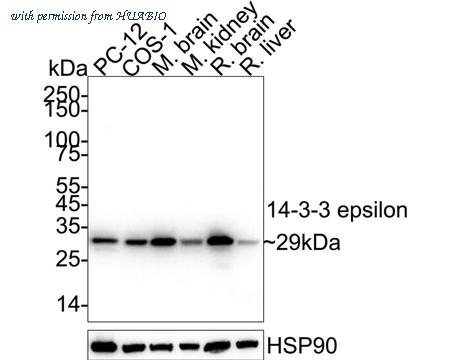 HUABIO ET1701-1 image 2