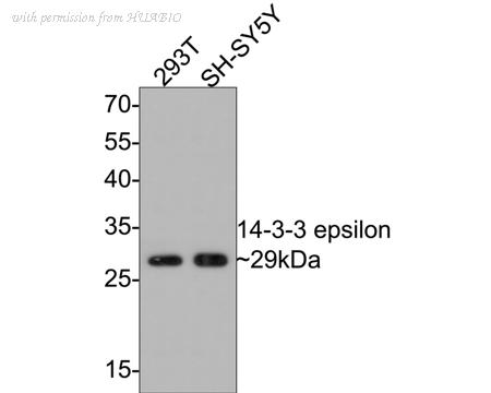 HUABIO ET1701-1 image 3