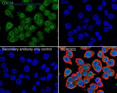 HUABIO ET1701-10 image 2