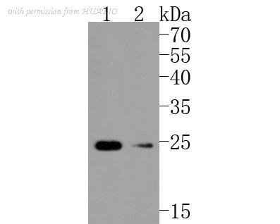 HUABIO ET1701-11 image 1