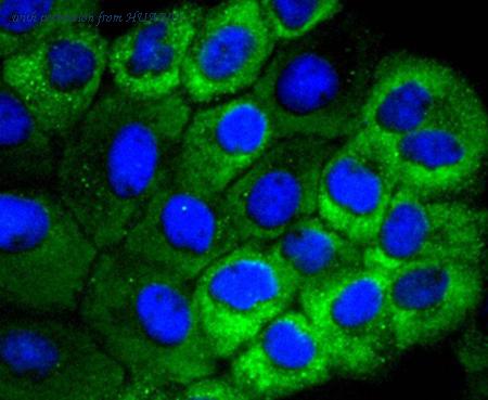 HUABIO ET1701-11 image 3