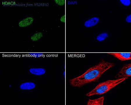 HUABIO ET1701-12 image 2