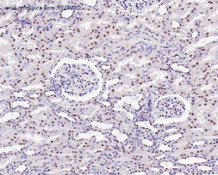 HUABIO ET1701-12 image 3