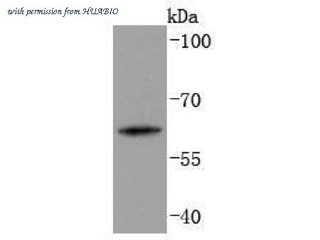 HUABIO ET1701-13 image 1