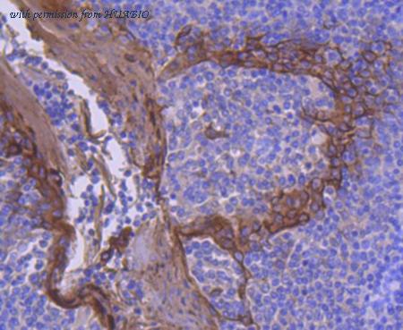 HUABIO ET1701-13 image 2