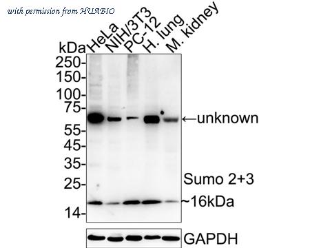 HUABIO ET1701-17 image 1