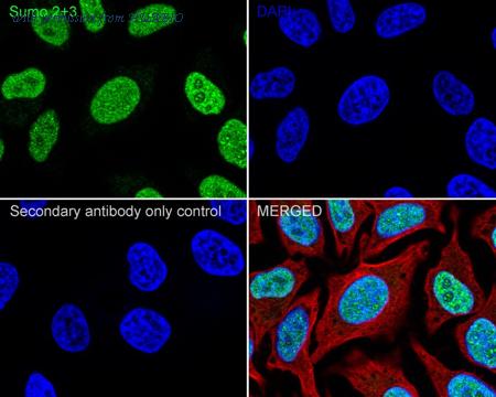 HUABIO ET1701-17 image 2