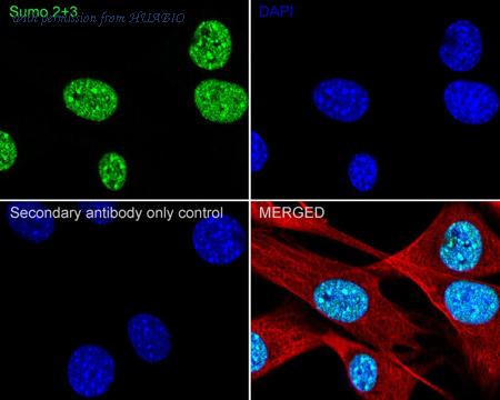 HUABIO ET1701-17 image 3