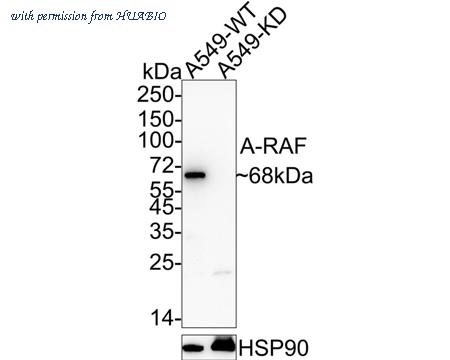 HUABIO ET1701-18 image 1