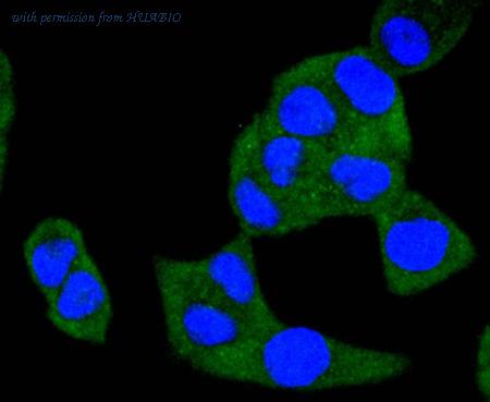 HUABIO ET1701-18 image 3