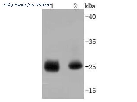 HUABIO ET1701-19 image 1