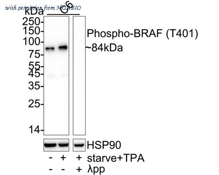 HUABIO ET1701-20 image 1