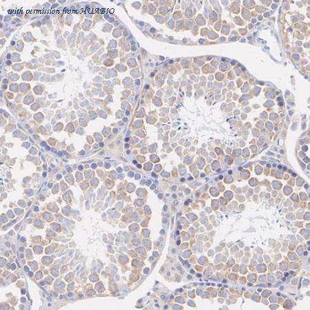 HUABIO ET1701-20 image 3