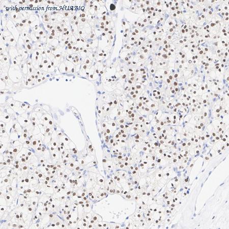 HUABIO ET1701-23 image 3