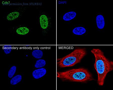 HUABIO ET1701-25 image 1