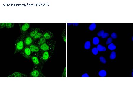 HUABIO ET1701-25 image 2