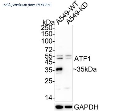 HUABIO ET1701-30 image 1