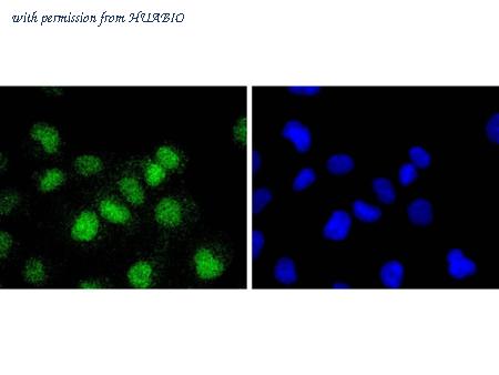 HUABIO ET1701-30 image 2