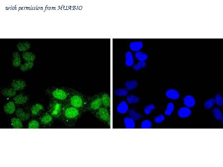 HUABIO ET1701-30 image 3