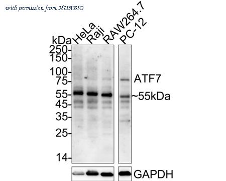 HUABIO ET1701-31 image 1