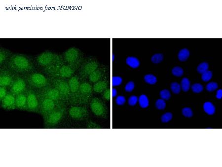 HUABIO ET1701-31 image 2