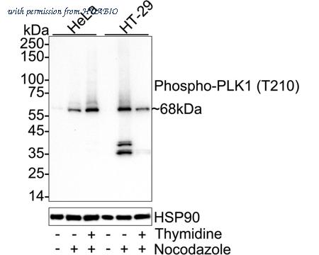 HUABIO ET1701-33 image 1