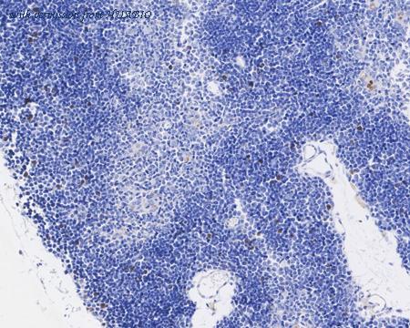 HUABIO ET1701-33 image 2