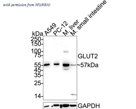 HUABIO ET1701-34 image 1