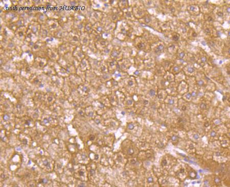 HUABIO ET1701-34 image 2