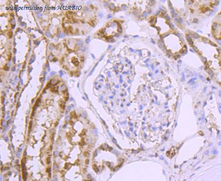 HUABIO ET1701-34 image 3