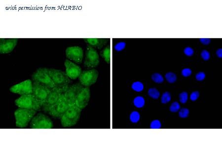 HUABIO ET1701-35 image 2