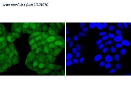 HUABIO ET1701-35 image 3