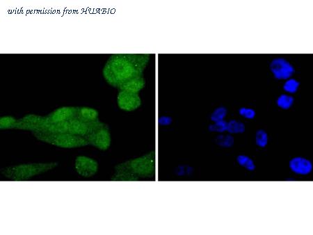 HUABIO ET1701-36 image 2