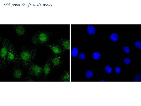 HUABIO ET1701-36 image 3