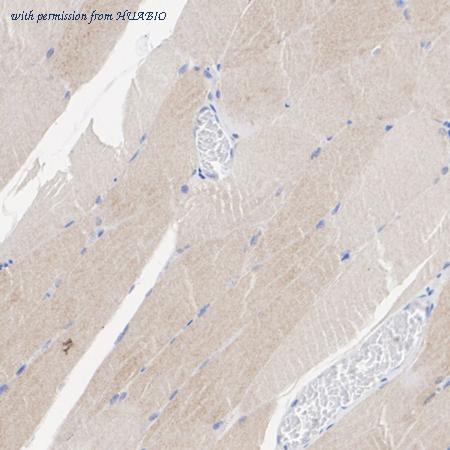 HUABIO ET1701-37 image 3